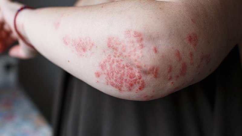 邢台皮肤医院:前沿科技与人文关怀并行的现代医疗典范
