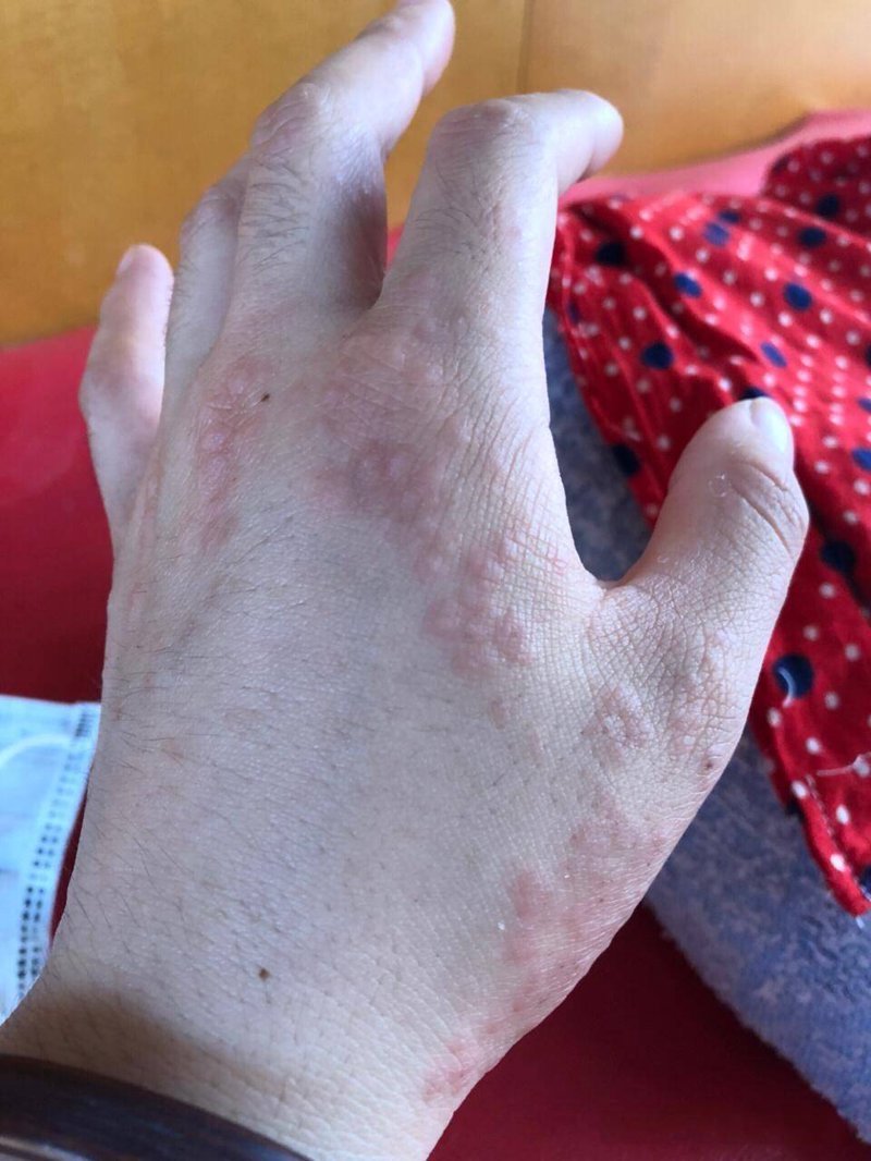 聚焦皮肤健康护理：探索邢台京城皮肤病医院的服务与技术